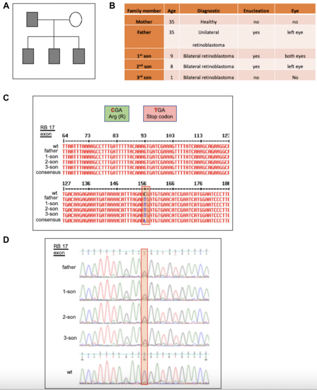 Pathogenic Variants in Retinoblastoma Suggest a Potential Gain-of-Function Mutation