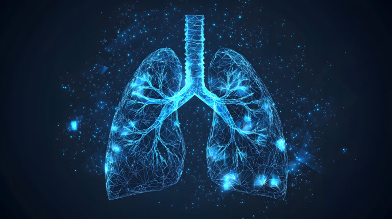 Lung cancer